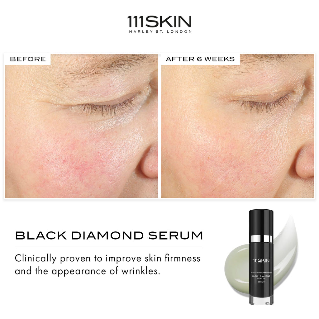 111SKIN Black Diamond Serum – Lightweight Firming Serum with NAC Y2