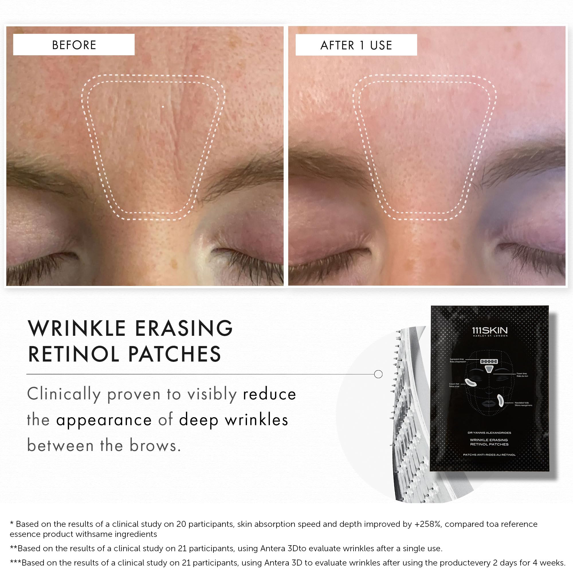 111SKIN Wrinkle Erasing Retinol Patches — Non-Invasive Forehead, Under-Eye & Smile Line, 3 x 1.23 oz