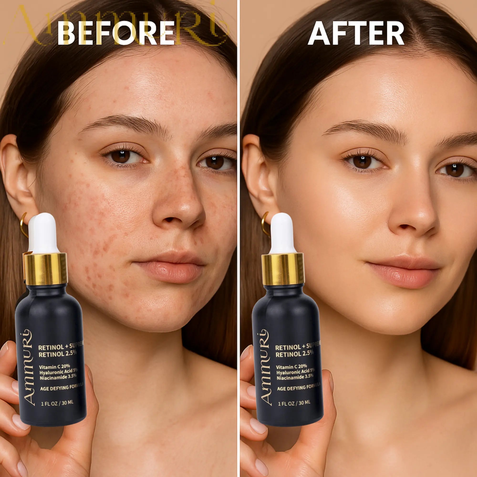 Ammuri Retinol 2.5% Supreme Serum – Gentle Anti-Ageing Treatment | 30ml