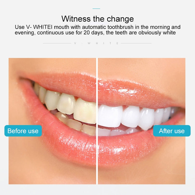Vwhite 3 Cleaning Modes Silicone Electric Automatic Beauty Tooth Instrument(Blue)