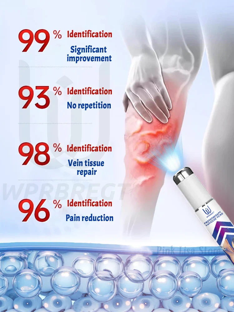 The second-generation laser says goodbye to spider leg veins in 7 days
