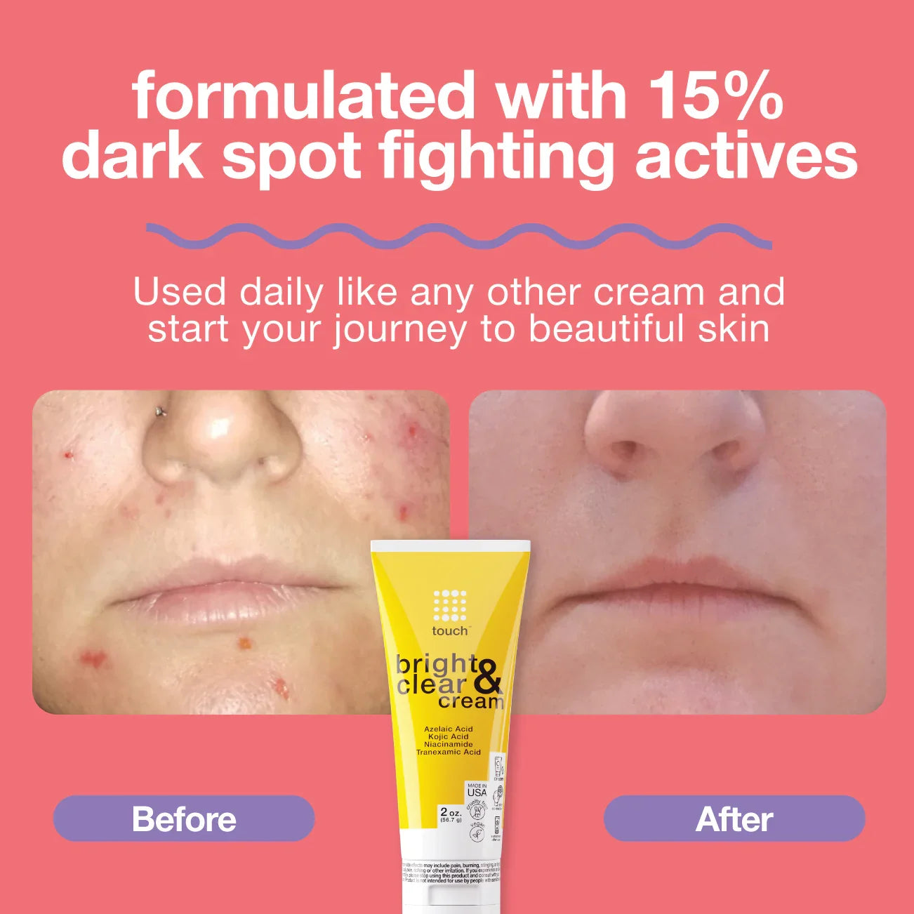 Touch Bright & Clear Cream with Azelaic Acid, Kojic Acid, Niacinamide