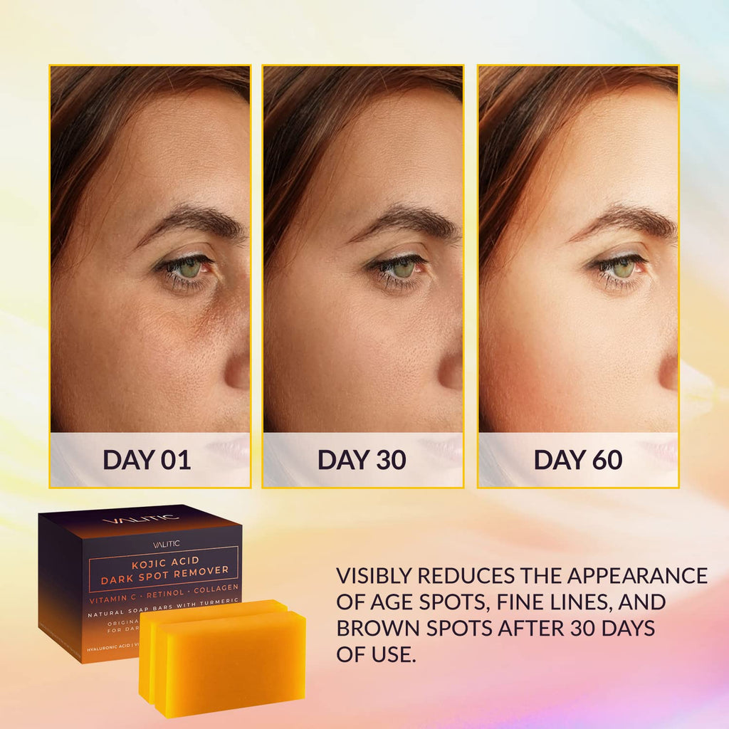 VALITIC Kojic Acid Dark Spot Remover Soap - with Retinol, Turmeric