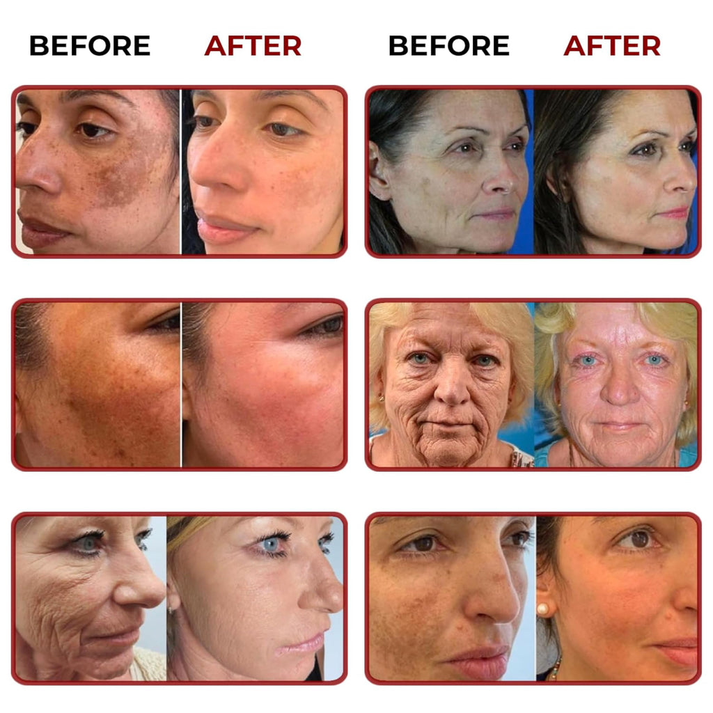 ABERA Renewing Saffron Serum – High-Potency Melasma Treatment with Hyaluronic Acid | 2 Boxes + Grapefruit Hair Regrowth Serum Gift