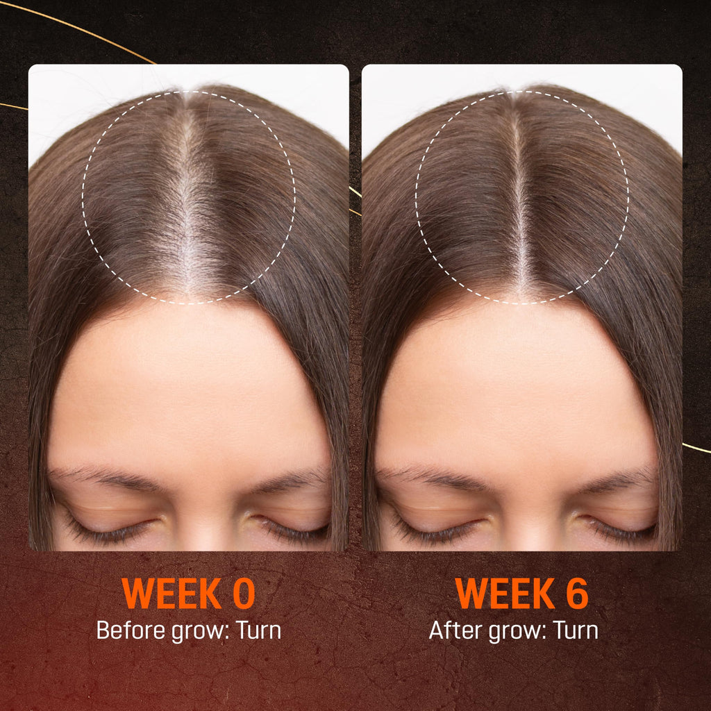 ABERA Hair Growth Serum – Natural Hair & Beard Support (Biotin & Castor Oil) | 1 Serum + Gift