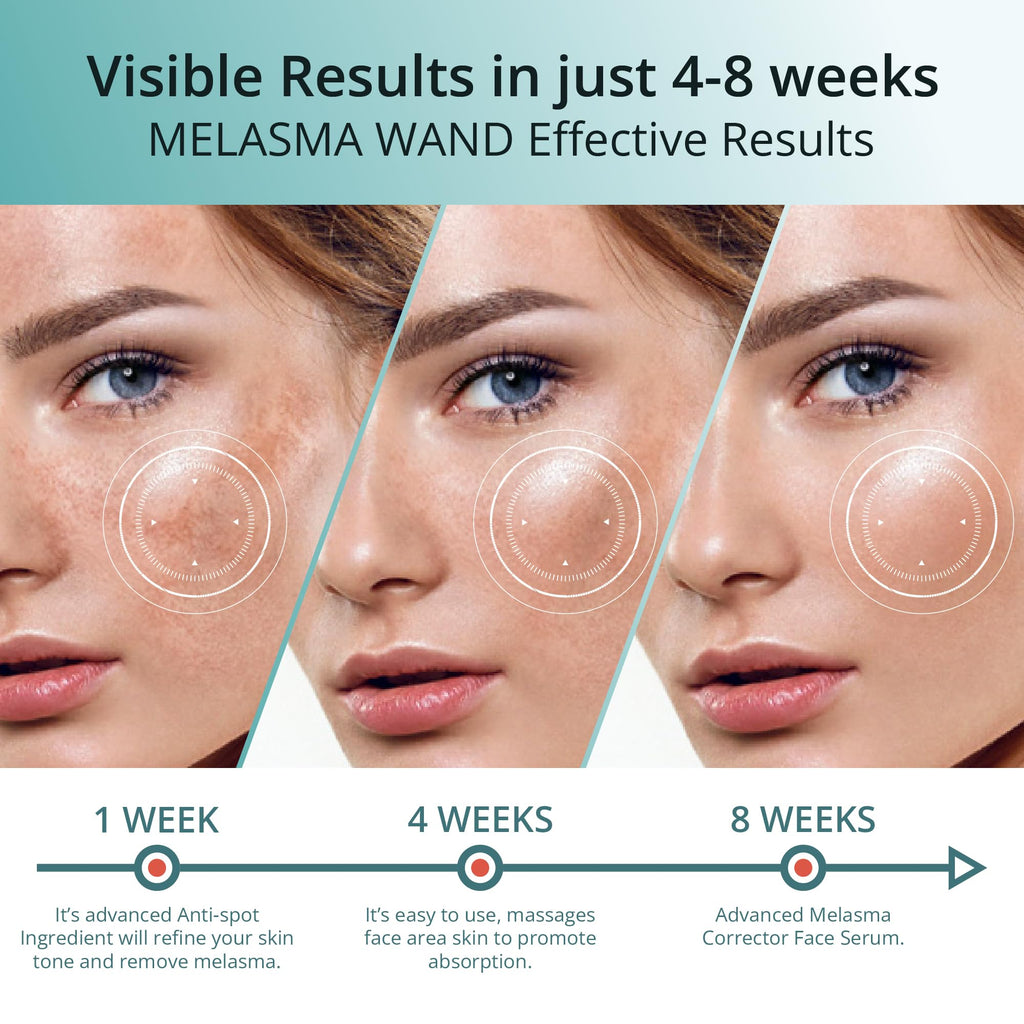 ABERA Melasma Serum – Melanin Correcting Facial Serum with Niacinamide & HA (0.68 fl oz)