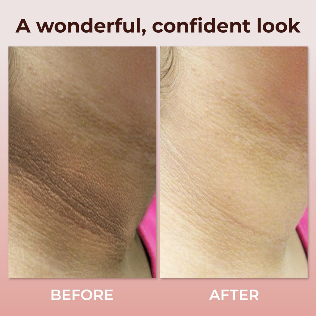 ABERA Collagen Neck Cream – Niacinamide, Even Tone, UV Protection