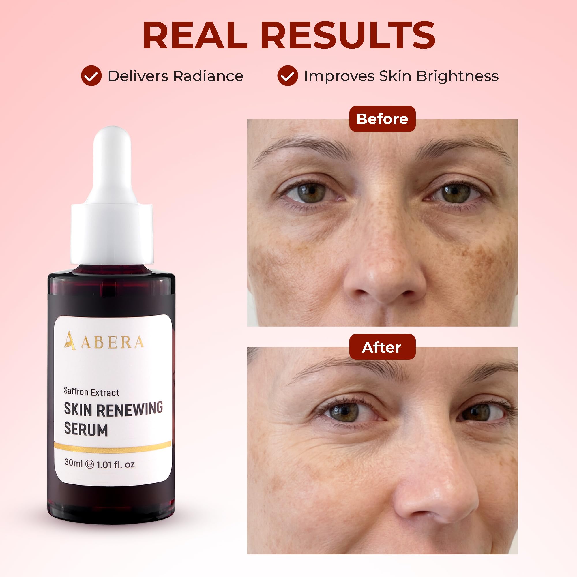 ABERA Renewing Saffron Serum – High-Potency Melasma Treatment with Hyaluronic Acid | 2 Boxes + Grapefruit Hair Regrowth Serum Gift