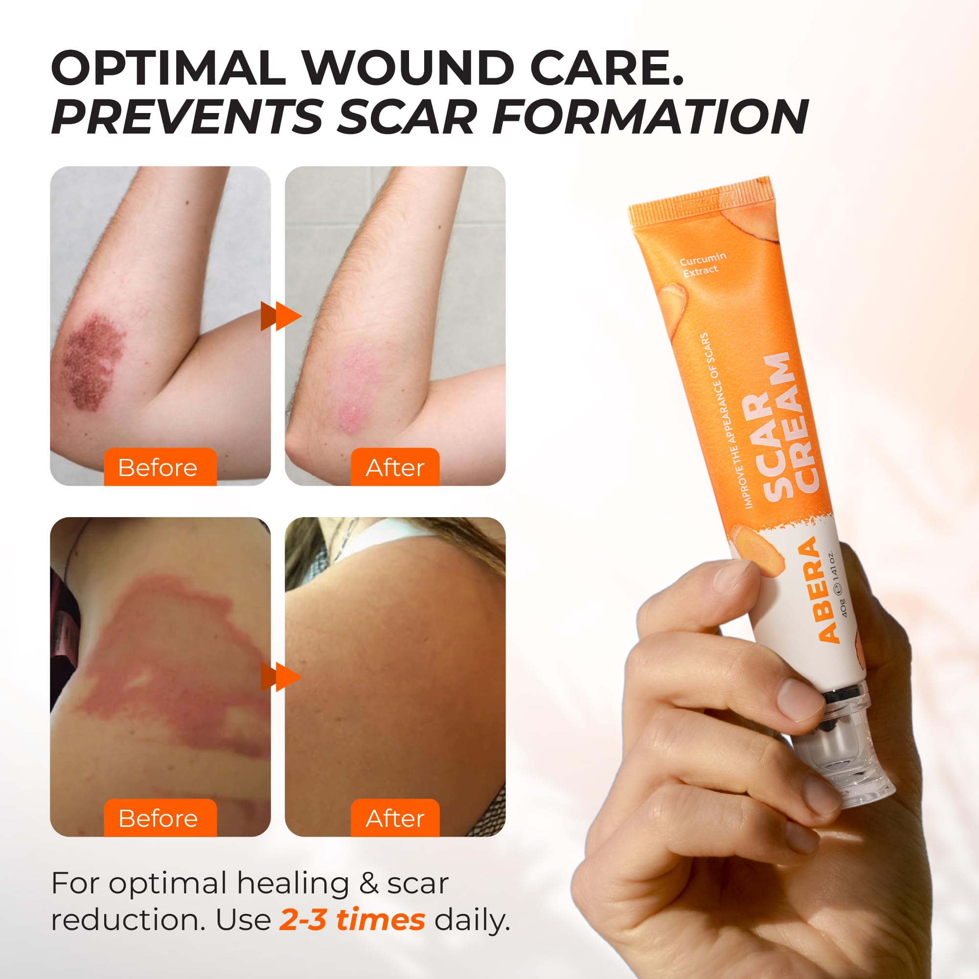 ABERA Scar Cream Upgrade – Skin Regeneration & Repair Cream for Wounds, Scratches & Irritated Skin (1.41 oz)