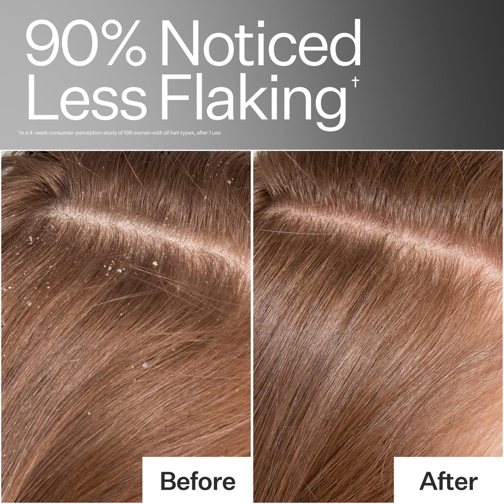 ACT+ ACRE Cold Processed Scalp Detox Oil — Sulfate-Free Scalp Care for Flaky, Dry & Itchy Scalp