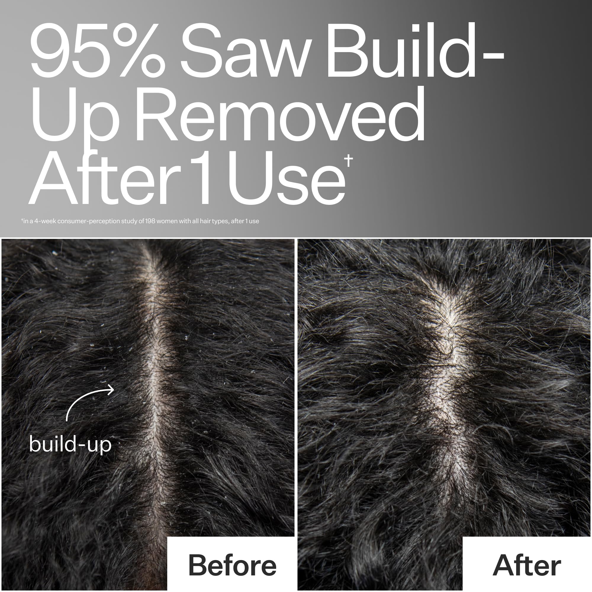 ACT+ ACRE Cold Processed Scalp Detox Oil — Sulfate-Free Scalp Care for Flaky, Dry & Itchy Scalp