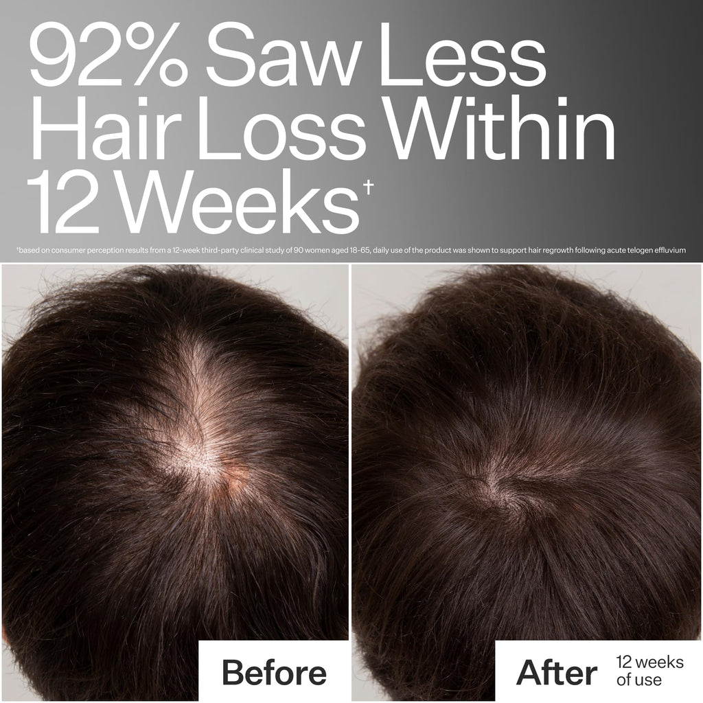 Act+Acre Cold Processed 3% Stem Cell Peptide Treatment – Boost Hair Density | Grape Stem Cells, Peptides + Caffeine | Vegan, Fragrance-Free | 3 fl oz