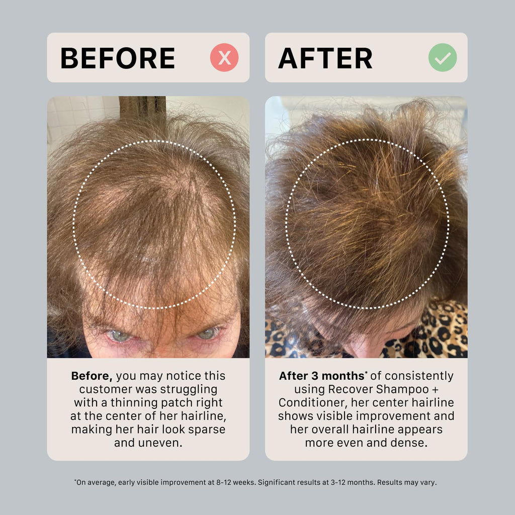ACTIIV Recover Thickening Conditioner – Hydrates, Strengthens, Color-Safe, 16 oz