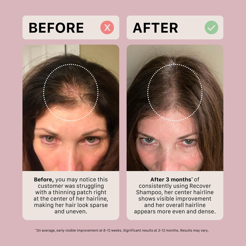 ACTIIV Recover Thickening Shampoo for Women | Fuller-Looking Hair, Plant-Based & Vegan | 80 mL