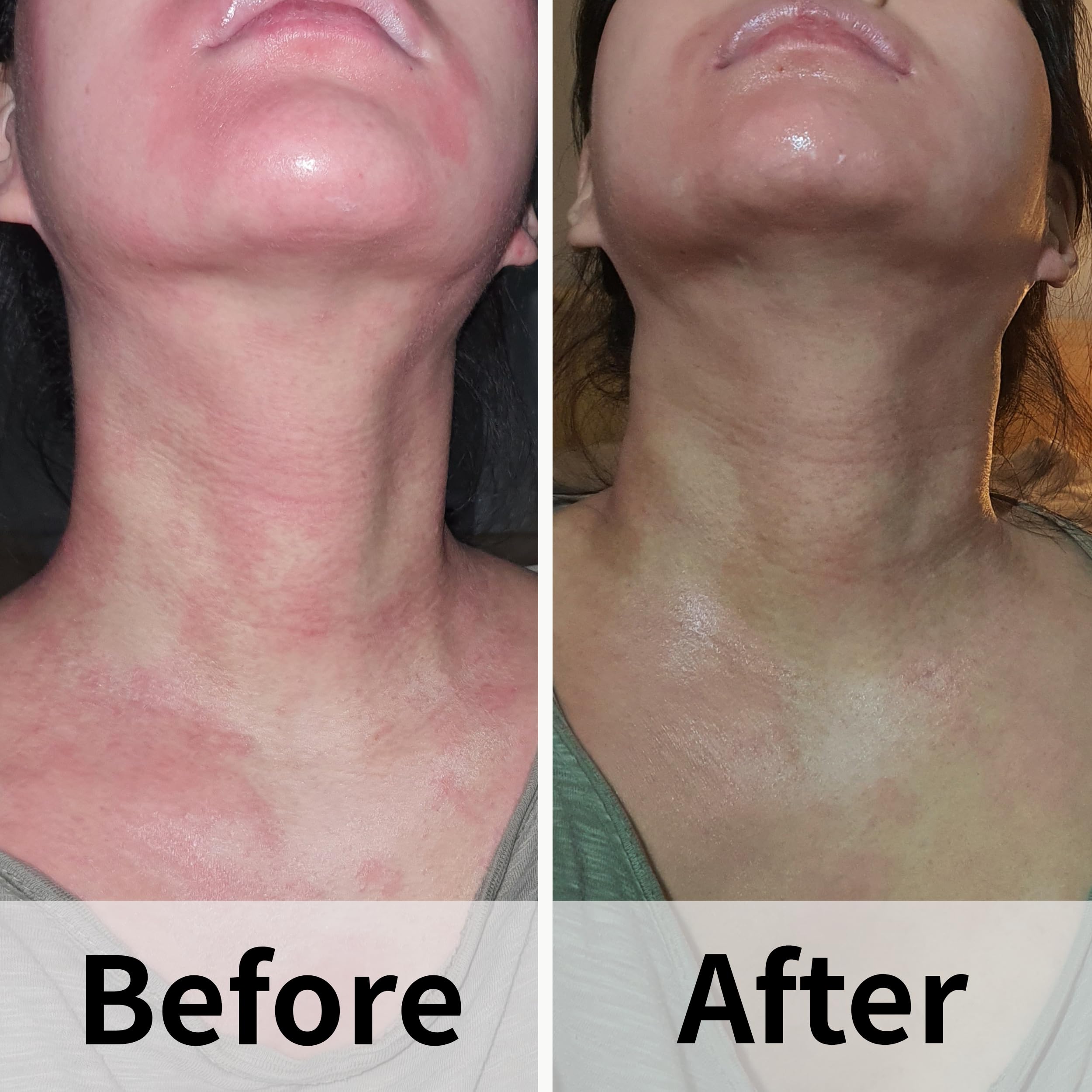 AD SOLUTION ATO Fast Calming Serum for Sensitive Skin | Itch Relief & Hydration