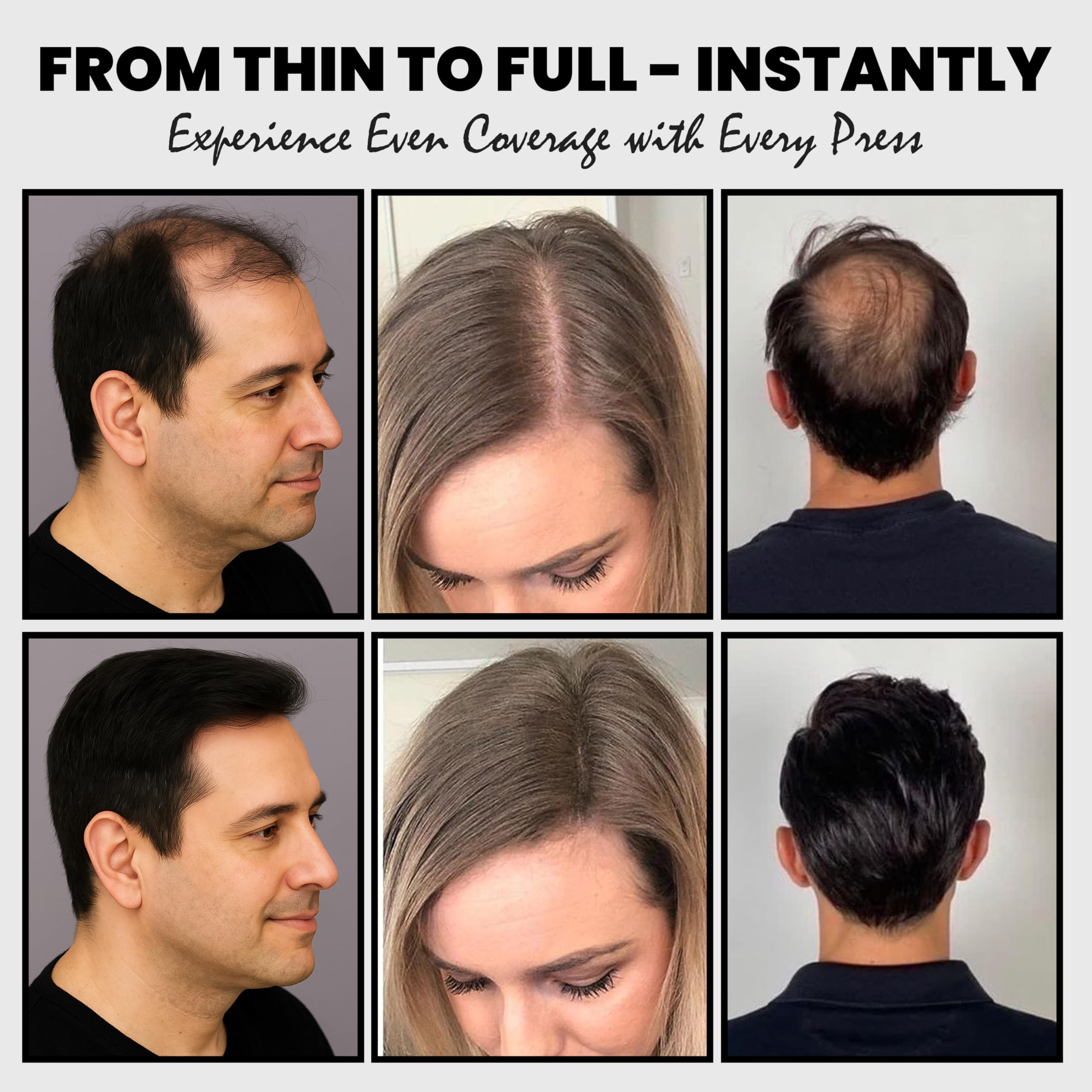 Adglamful Hair Fibers for Thinning Hair – Lightweight Building Fibers with Spray Applicator (Light Brown, 30g)
