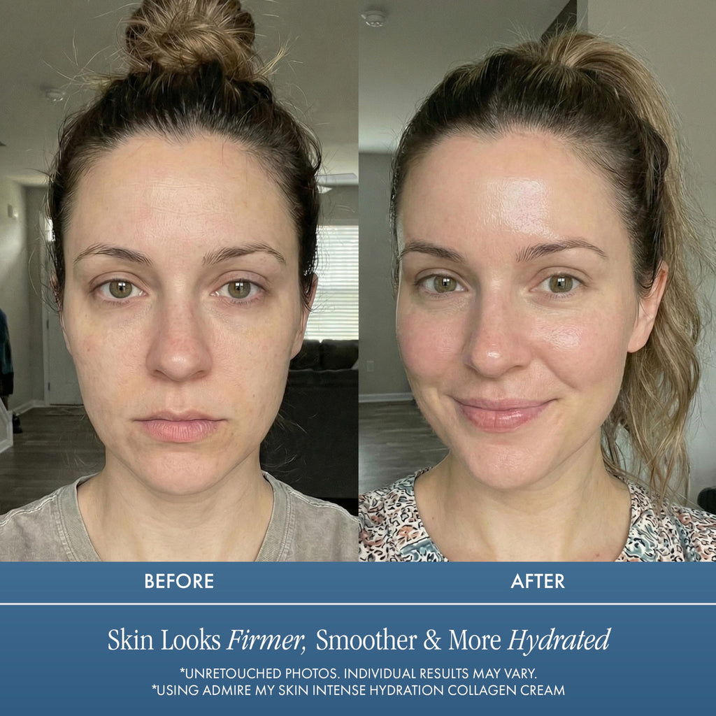 Admire My Skin Collagen Cream Moisturizer for Dry Skin | Hyaluronic Acid & Non-Comedogenic Hydration | 2oz