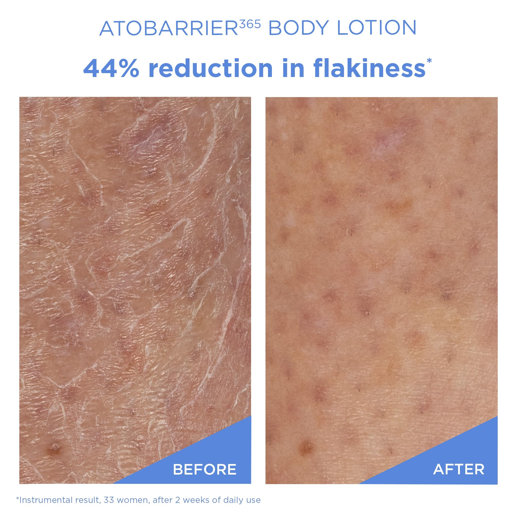 AESTURA ATOBARRIER365 Ceramide Body Lotion | Fast-Absorbing, Fragrance-Free for Dry & Sensitive Skin | 400 mL