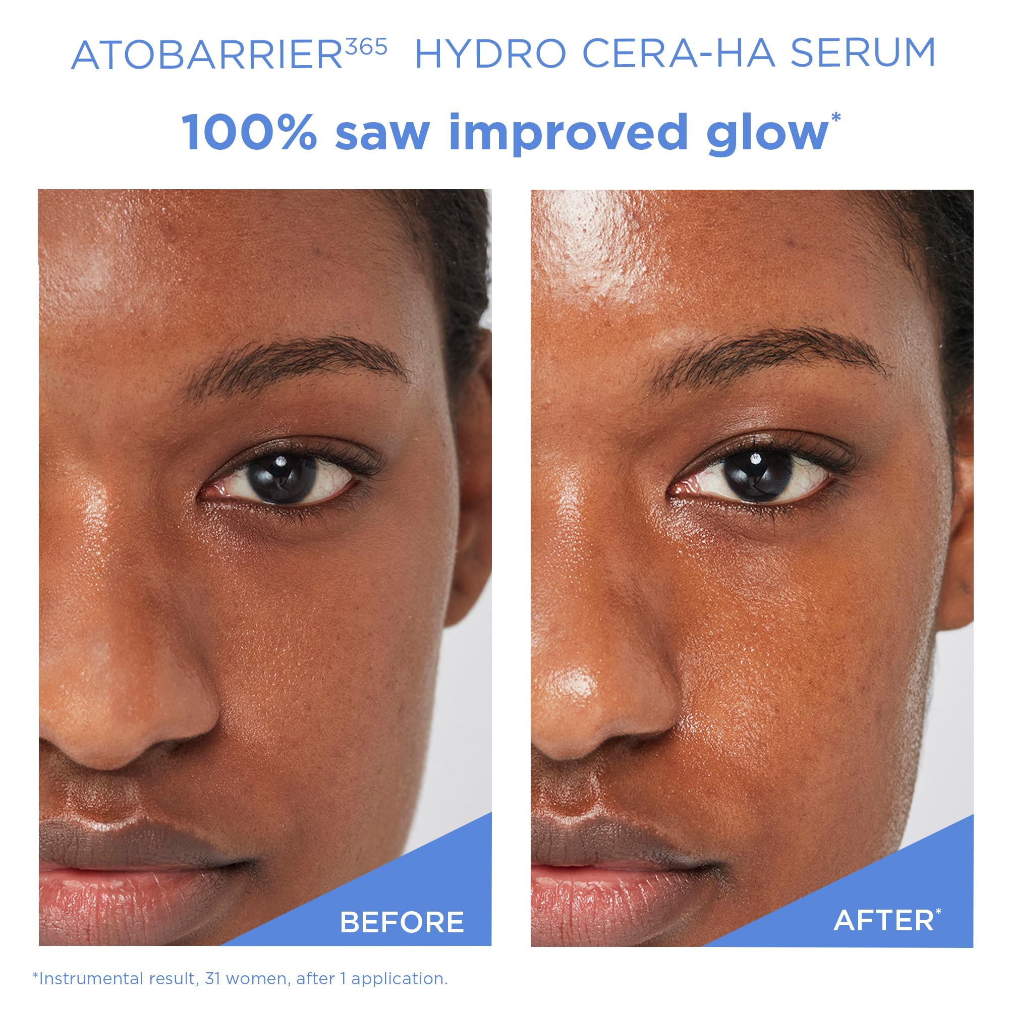 AESTURA ATOBARRIER365 Hydro CERA-HA Serum — Ceramides, Hyaluronic Acid & Niacinamide for Deep Hydration | 30ml