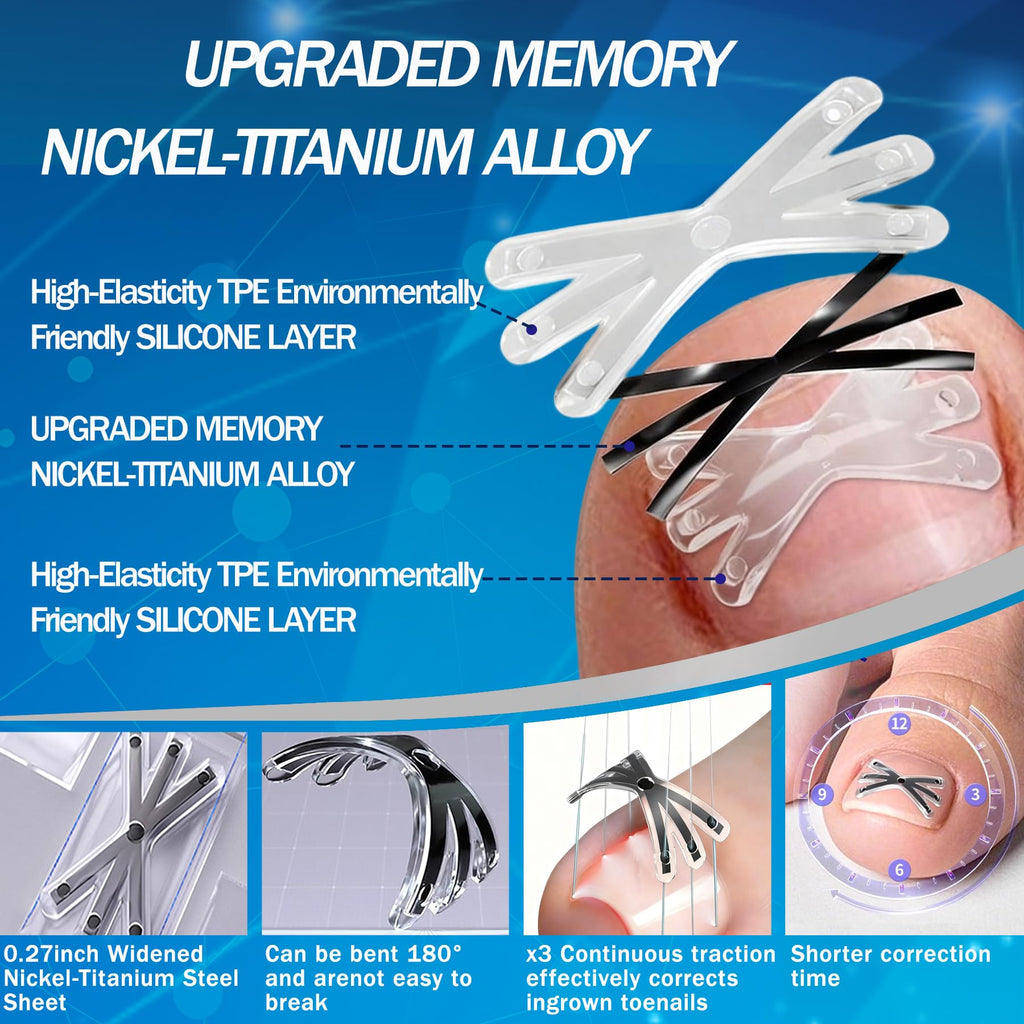 Aethyron Ingrown Toenail Corrector | Upgraded 6-Angle Titanium Alloy Kit (9 Pcs)