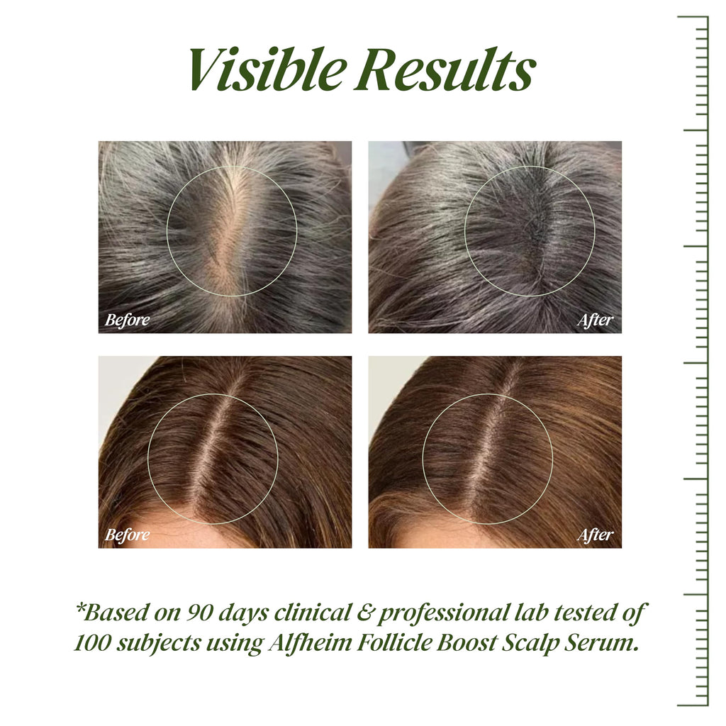 ALFHEIM Saw Palmetto Scalp Serum — Fuller Hair, Caffeine & Biotin, 0.34 oz