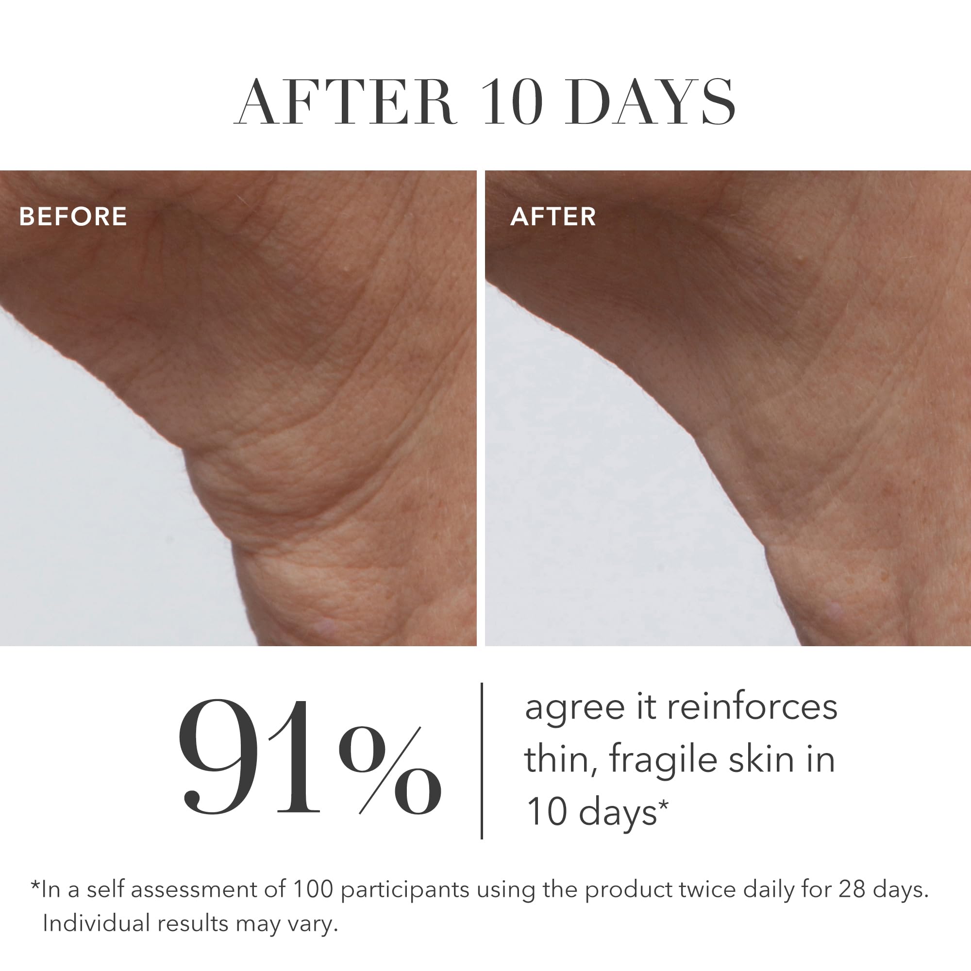 Algenist GENIUS Ultimate Anti-Aging Cream – Restore Elasticity, Smooth Fine Lines