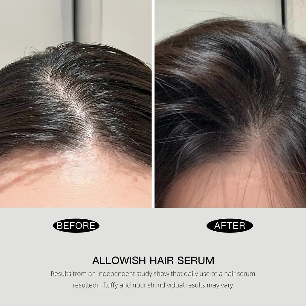 ALLOWISH Advanced Hair Serum - 95 ml Scalp Treatment for Fuller, Glossy Hair | Frizz Control & Healthy Roots