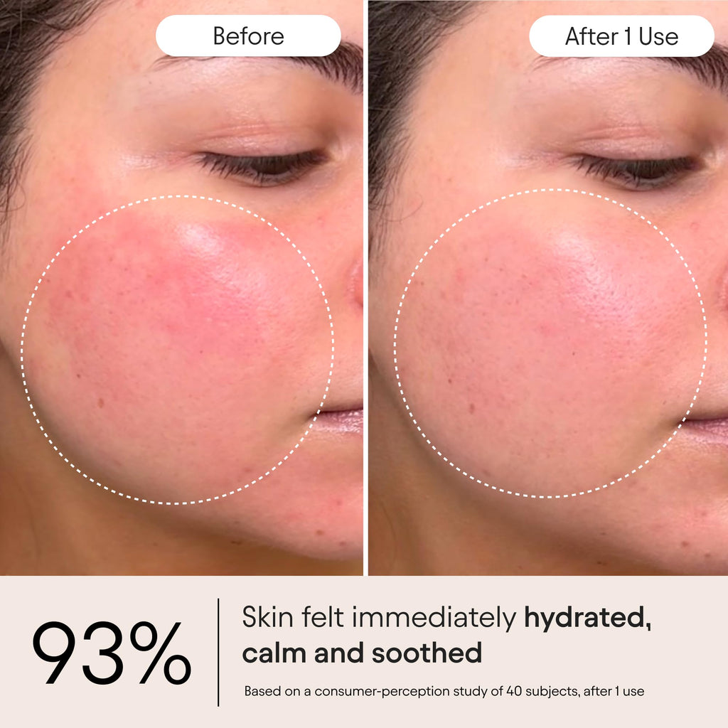 Alpyn Beauty Super Peptide & Ghostberry Moisturizer — Soothe Redness, Support Barrier & Wrinkles | 1.7 oz