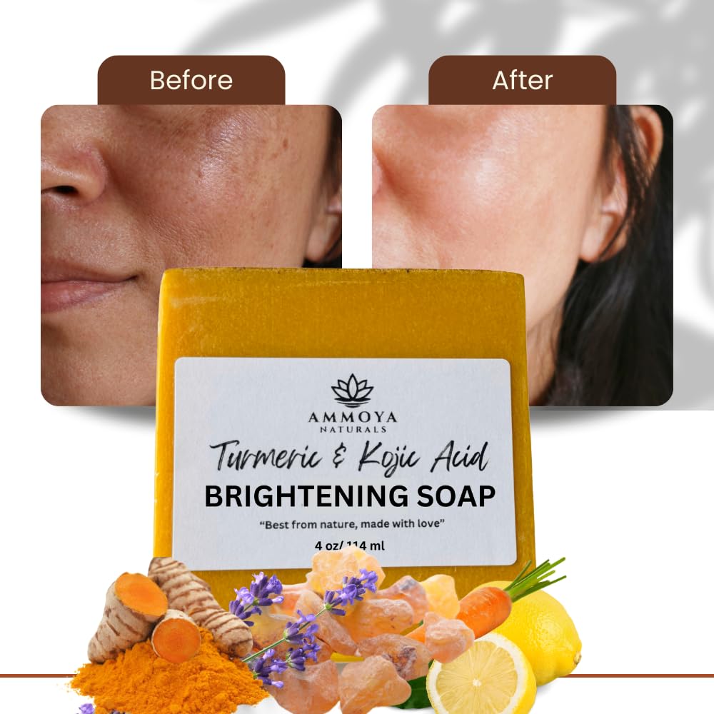 Turmeric Skin Cleansing Soap – Ammoya Naturals | Natural Glow Face & Body Cleanser (2 Bars, 4.5 oz)