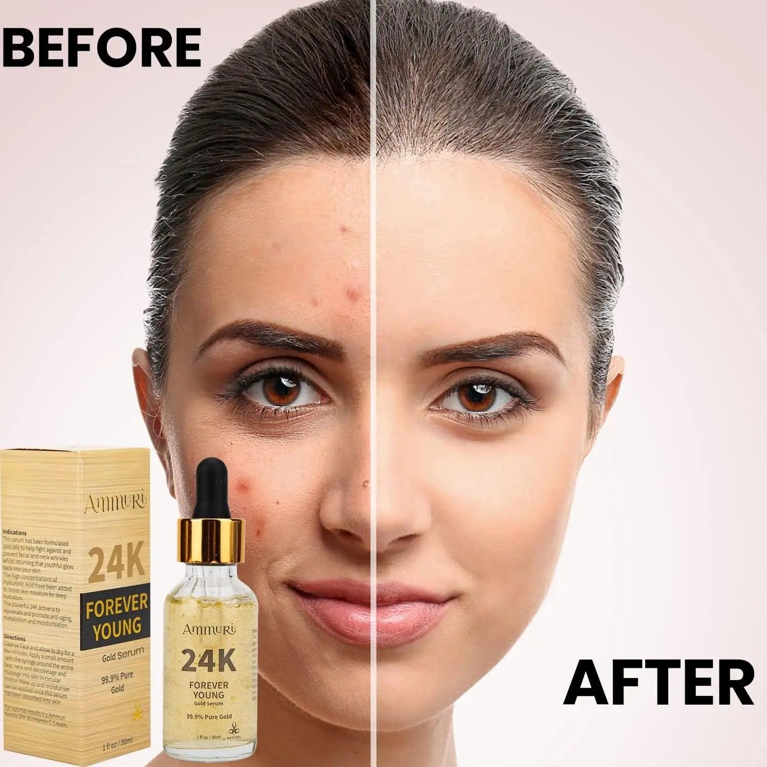 Ammuri 24K Gold Face Serum - Anti-Ageing Collagen Booster Dark Circle Treatment