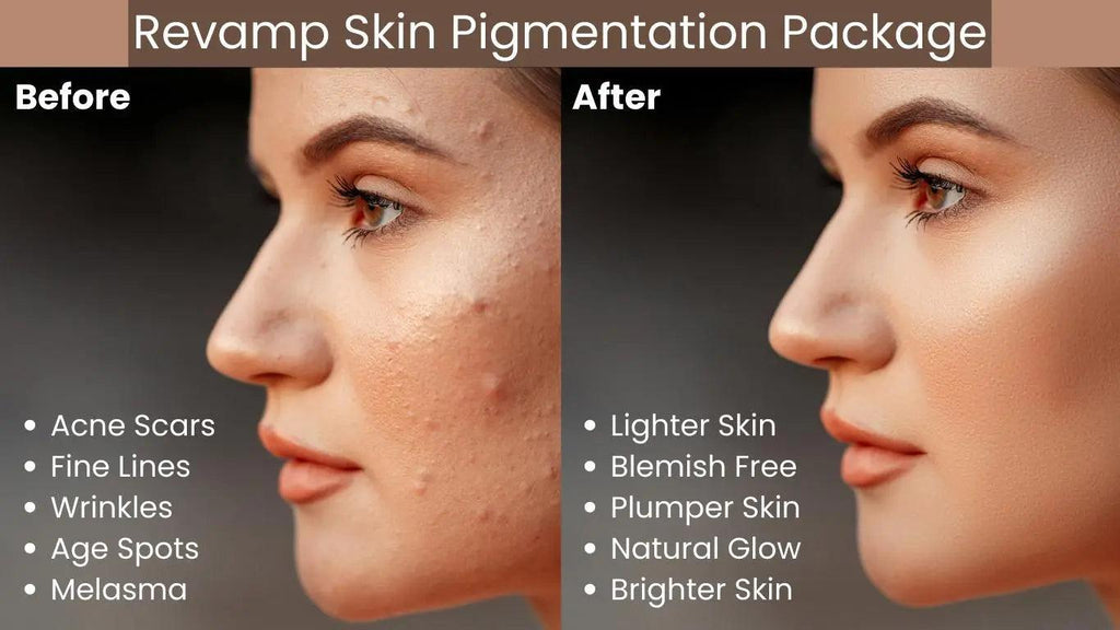 Ammuri Pigmentation Skincare Gift Set - Brightening Dark Spot Treatment Bundle