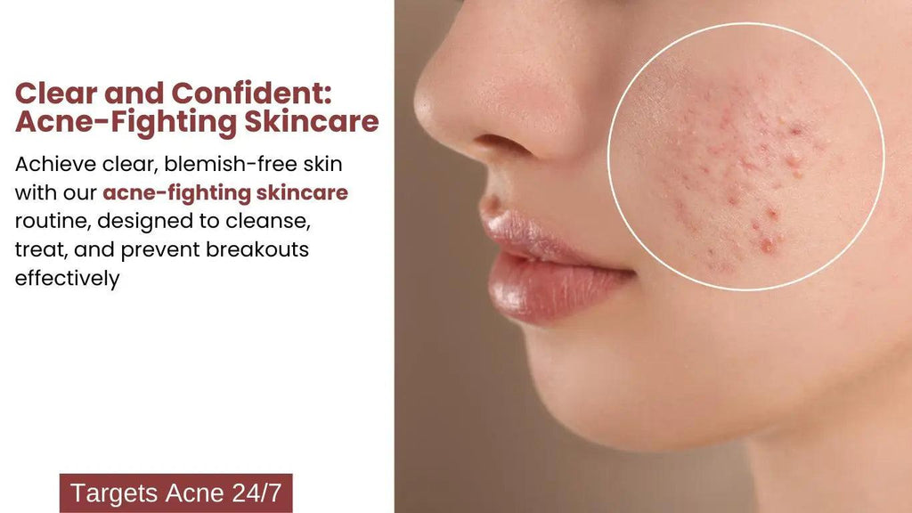 Ammuri Skincare Pigmentation Corrector Skincare Package