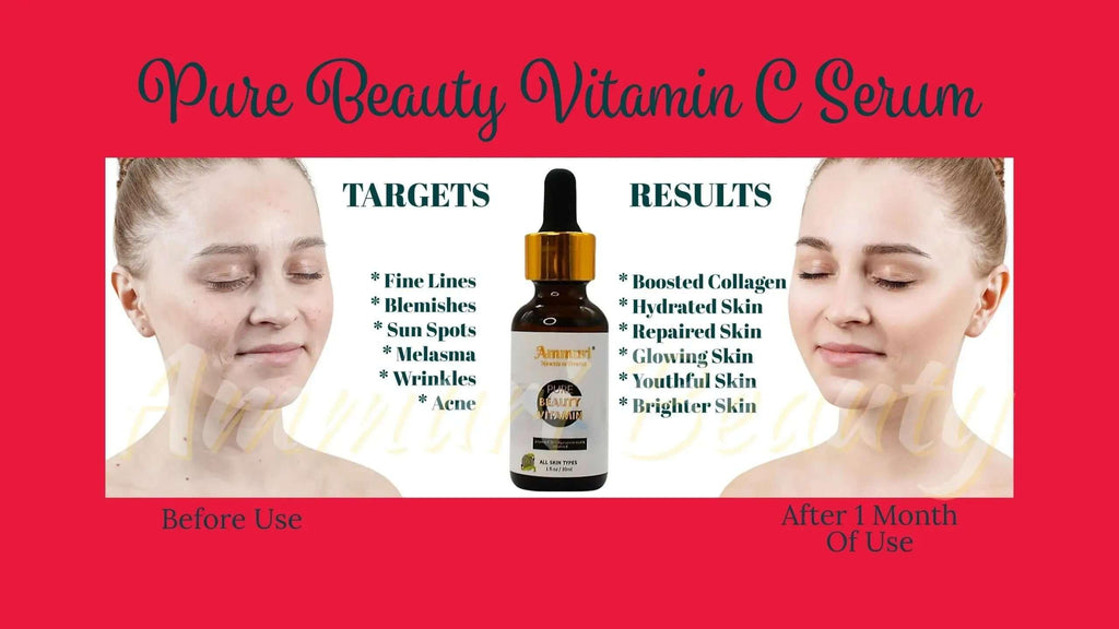 Ammuri Vitamin C Brightening Serum – Anti-Ageing Dark Spot Treatment 30ml