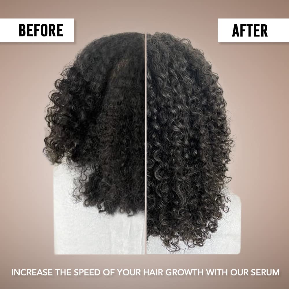 Amyla Cosmetics Hair Growth Serum for Women – 1 fl oz (30 mL)