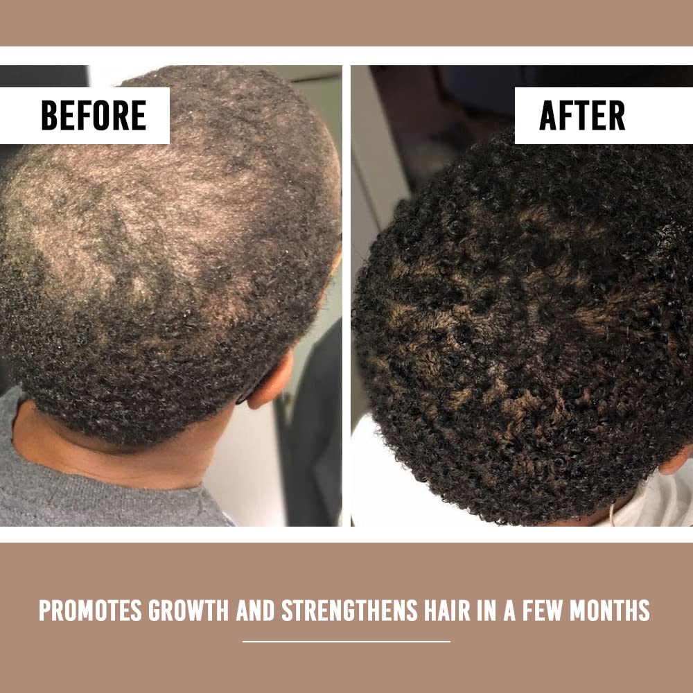 Amyla Cosmetics Hair Growth Serum for Women – 1 fl oz (30 mL)