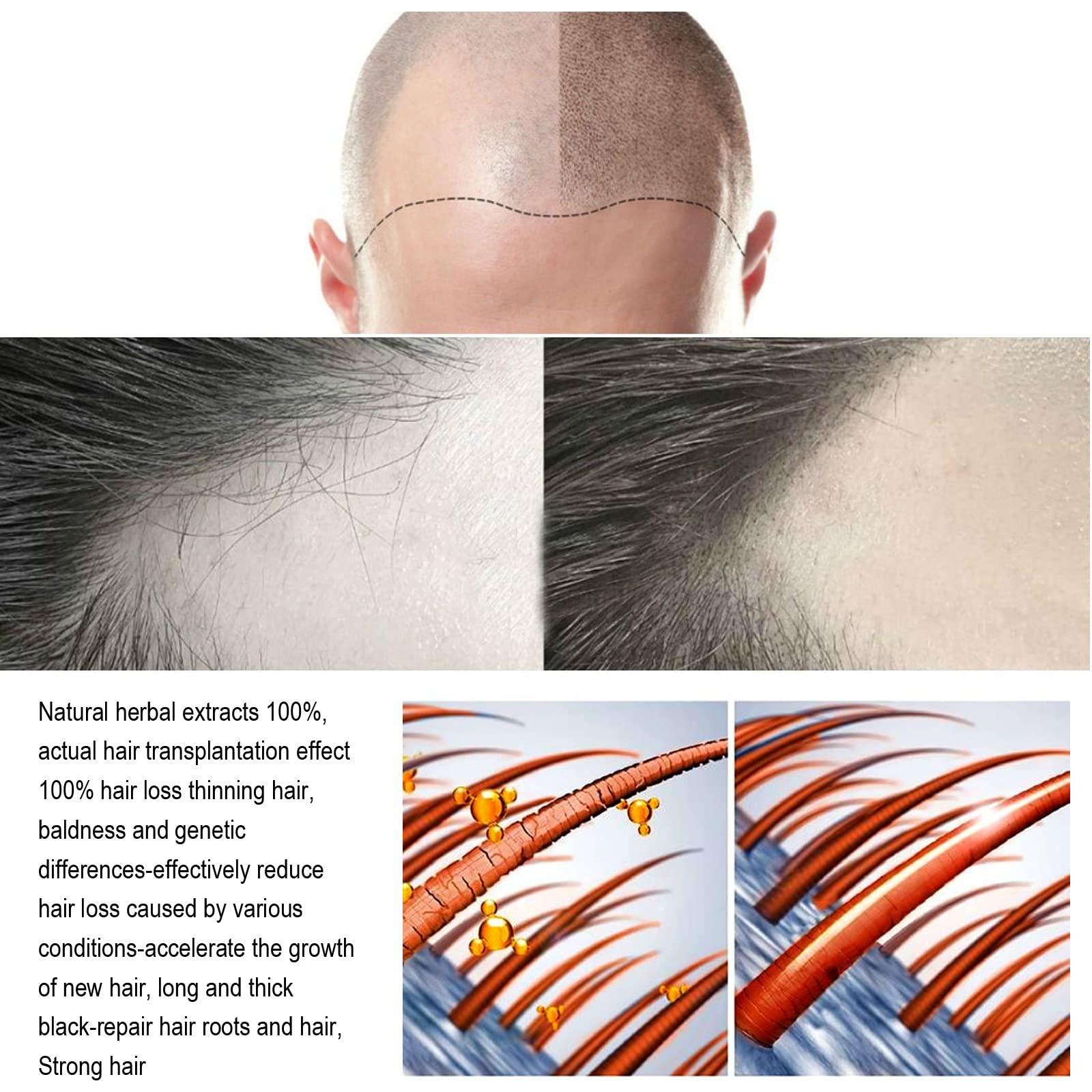 Hair Regrowth System | ANEFOSE — Ginseng, Eclipta Prostrata, Peppermint Oil & Ginger Root for Thicker Hair