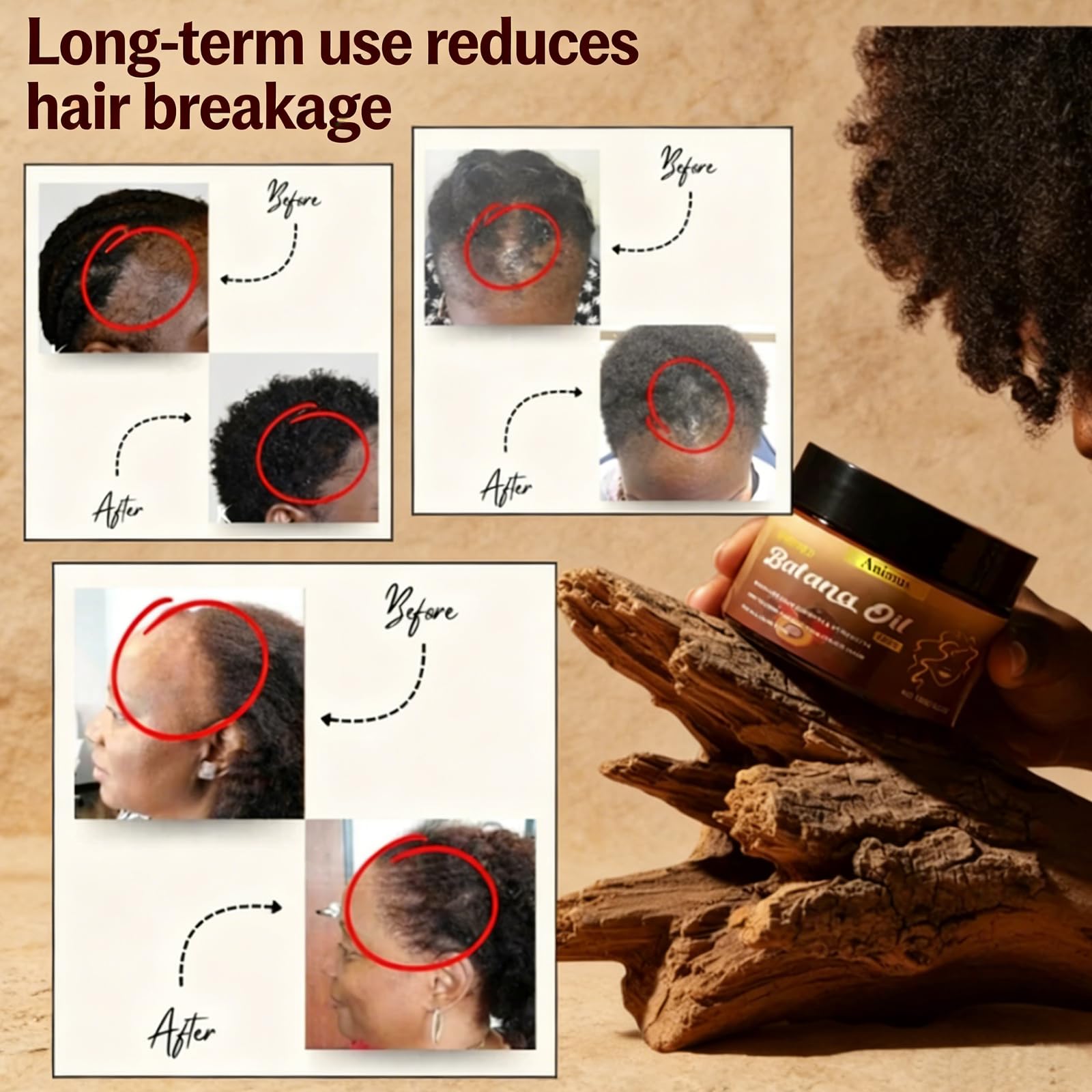 Animus Batana Oil – 100% Pure Batana Paste Hair Mask for All Hair Types