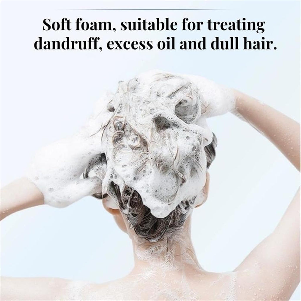 10.55 fl oz Anti-Dandruff Shampoo – Oil Control for All Hair Types (Men & Women)