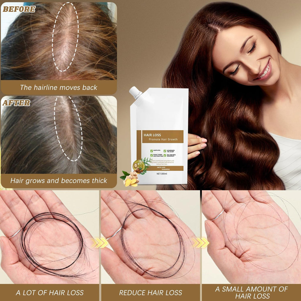 Anti-Hair Fall Shampoo for All Hair Types | Plant Extracts for Healthy-Looking Hair 300ml