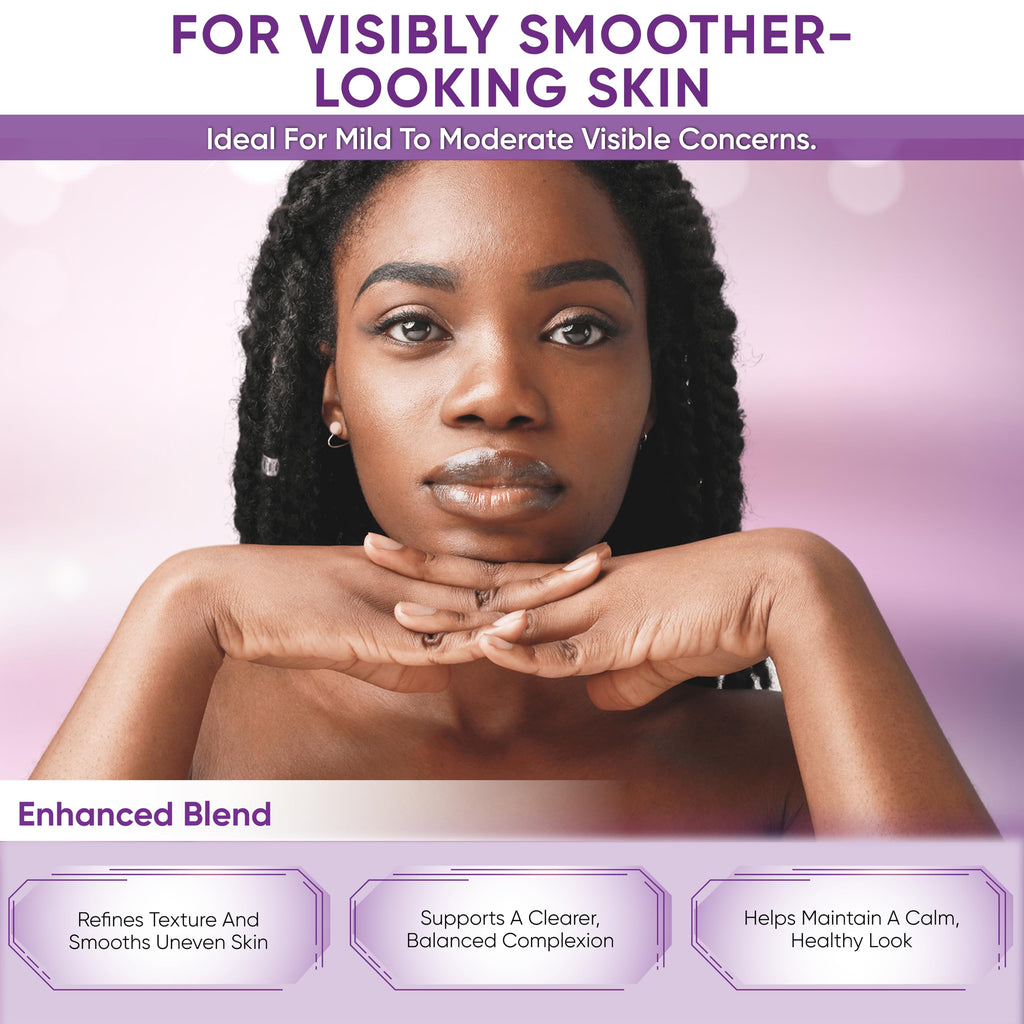 AOBBIY Azelaic Acid Cream for Face – Redness-Soothing, Even Tone, Pore Care (1 oz)
