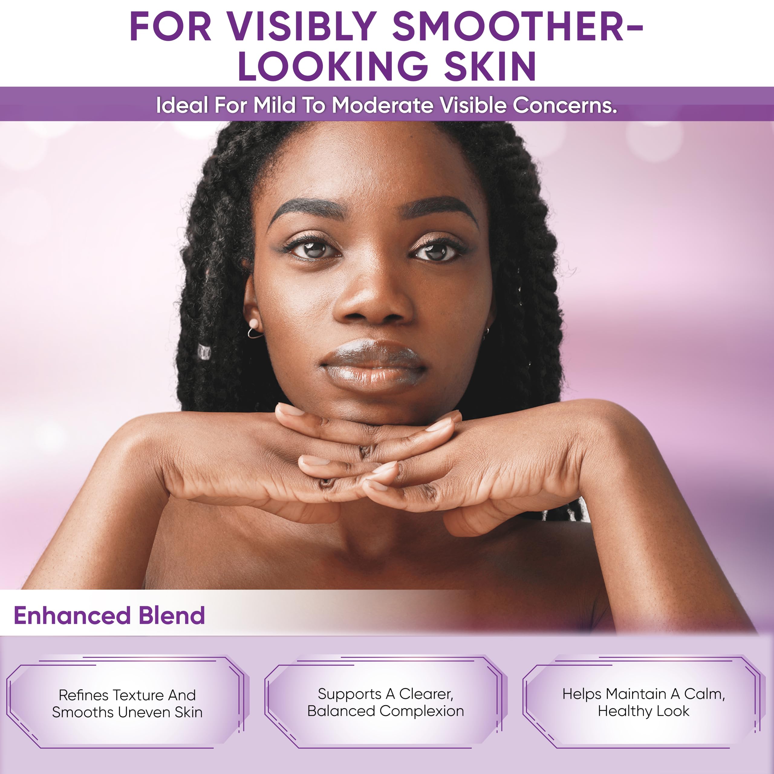 AOBBIY Azelaic Acid Cream for Face – Redness-Soothing, Even Tone, Pore Care (1 oz)