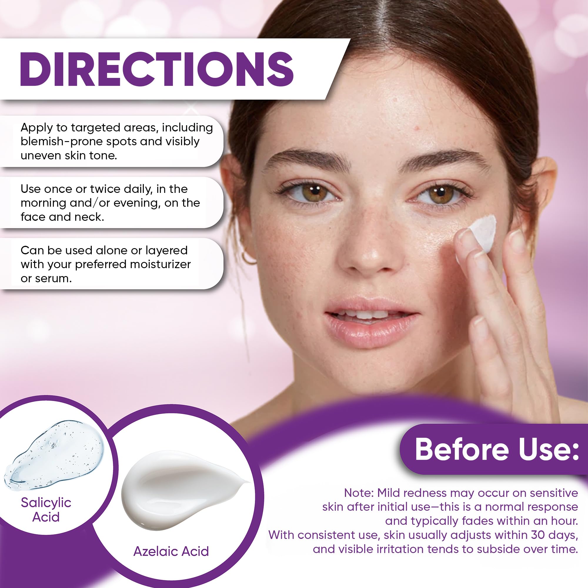 AOBBIY Azelaic Acid Cream for Face – Redness-Soothing, Even Tone, Pore Care (1 oz)