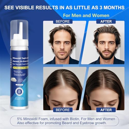 AOOLCF 5% Minoxidil Foam with Biotin – Hair Growth Treatment for Men & Women, 12.66 oz, 6-Month Supply