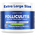 AOSORW Folliculitis & Acne Treatment Cream – 1% Salicylic Acid & Herbal Extracts, 100g