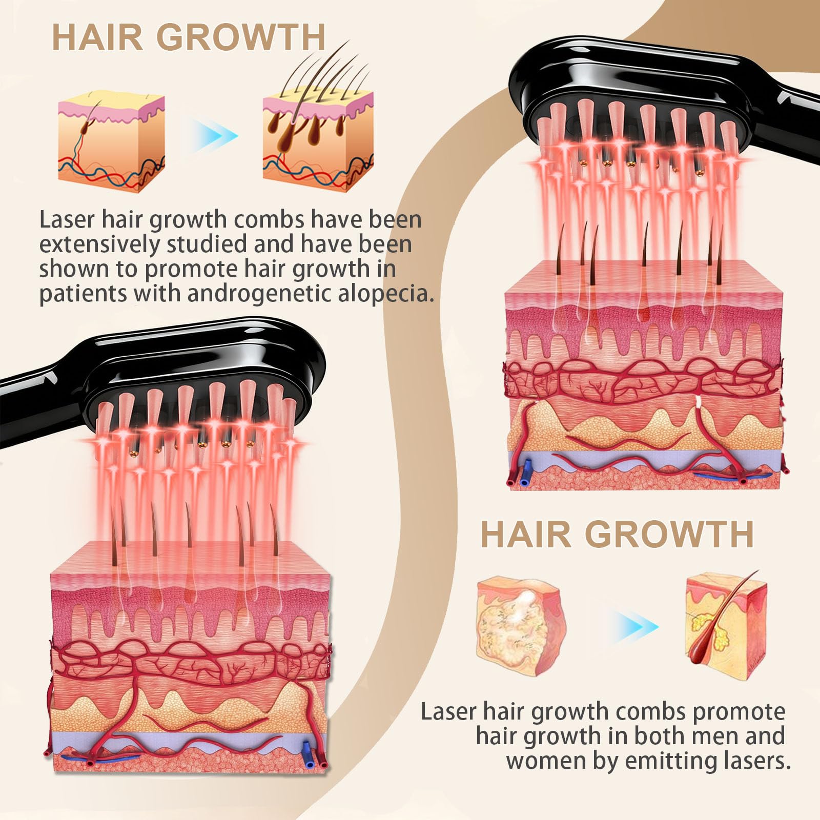 Apbier Laser Hair Growth Comb – At-Home Laser Therapy for Hair Growth