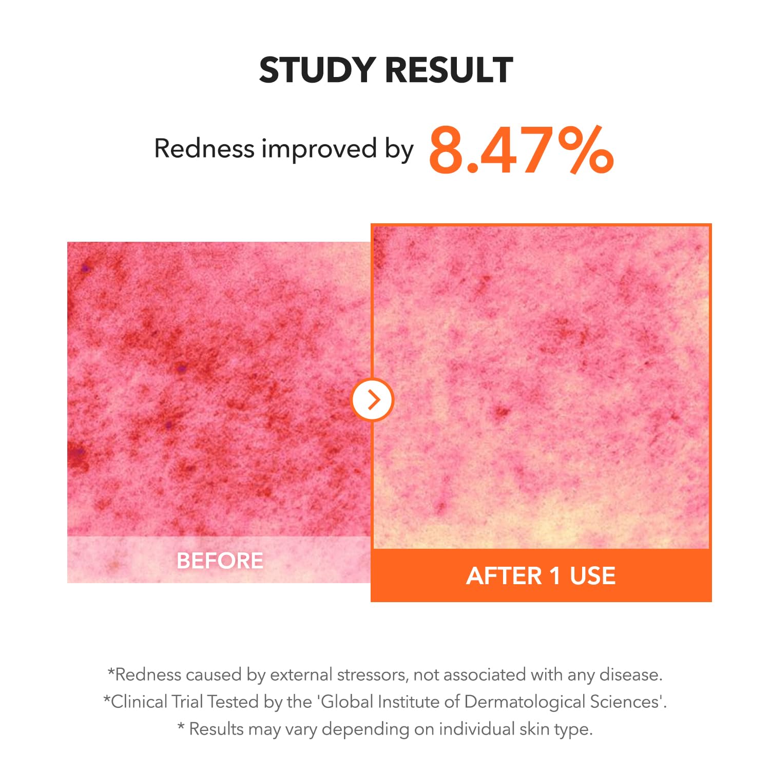 APRILSKIN Carrotene IPMP Clearing Solution | Quick Blemish Calm, 0.67 fl oz, Vegan