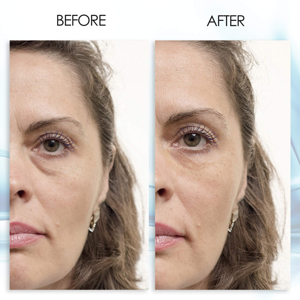 Aqua Mineral Puffy Eye Gel – Instant Puffiness Reduction & Hydration (1 oz)