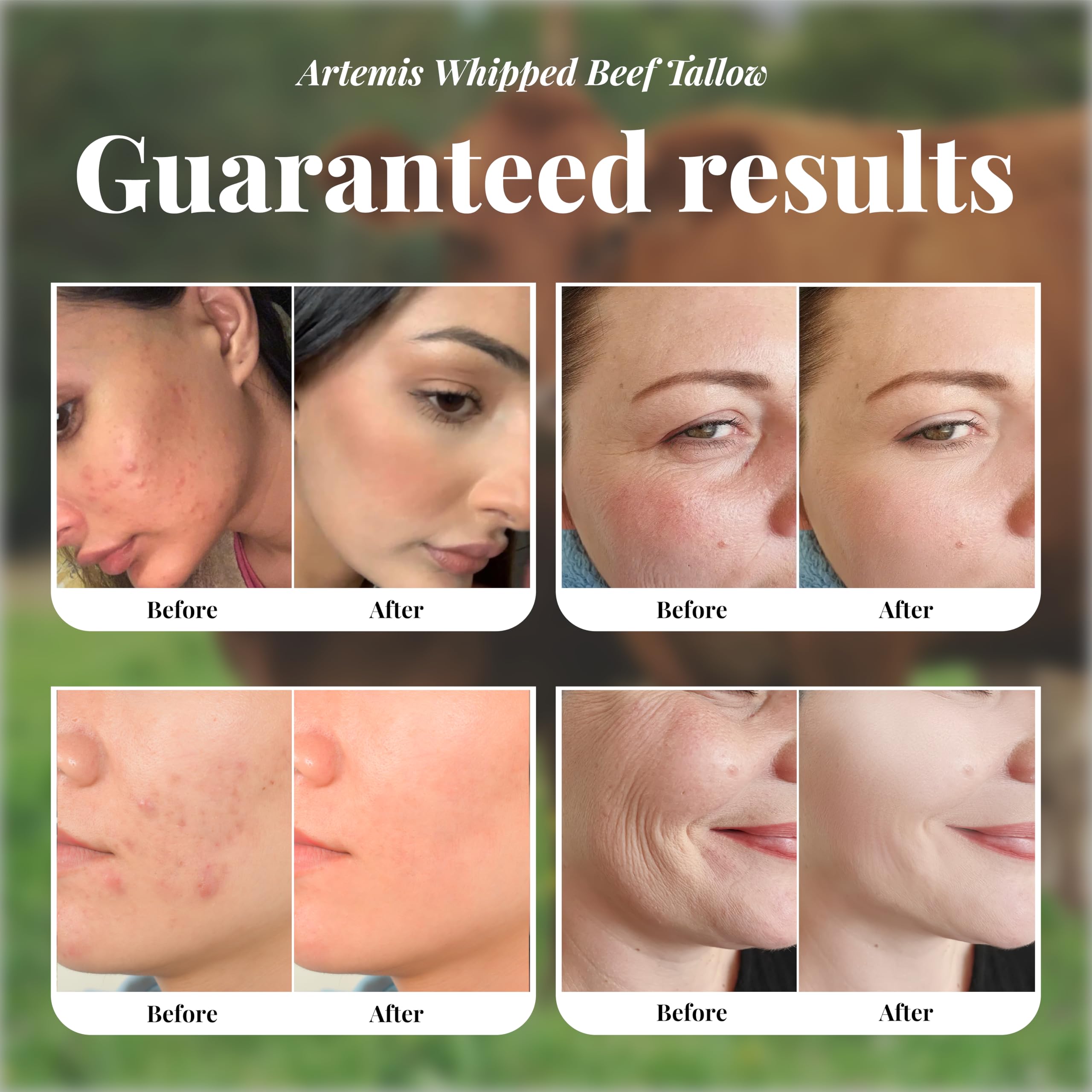 Artemis Beef Tallow Balm for Skin – Grass-Fed Moisturizer, 6 oz