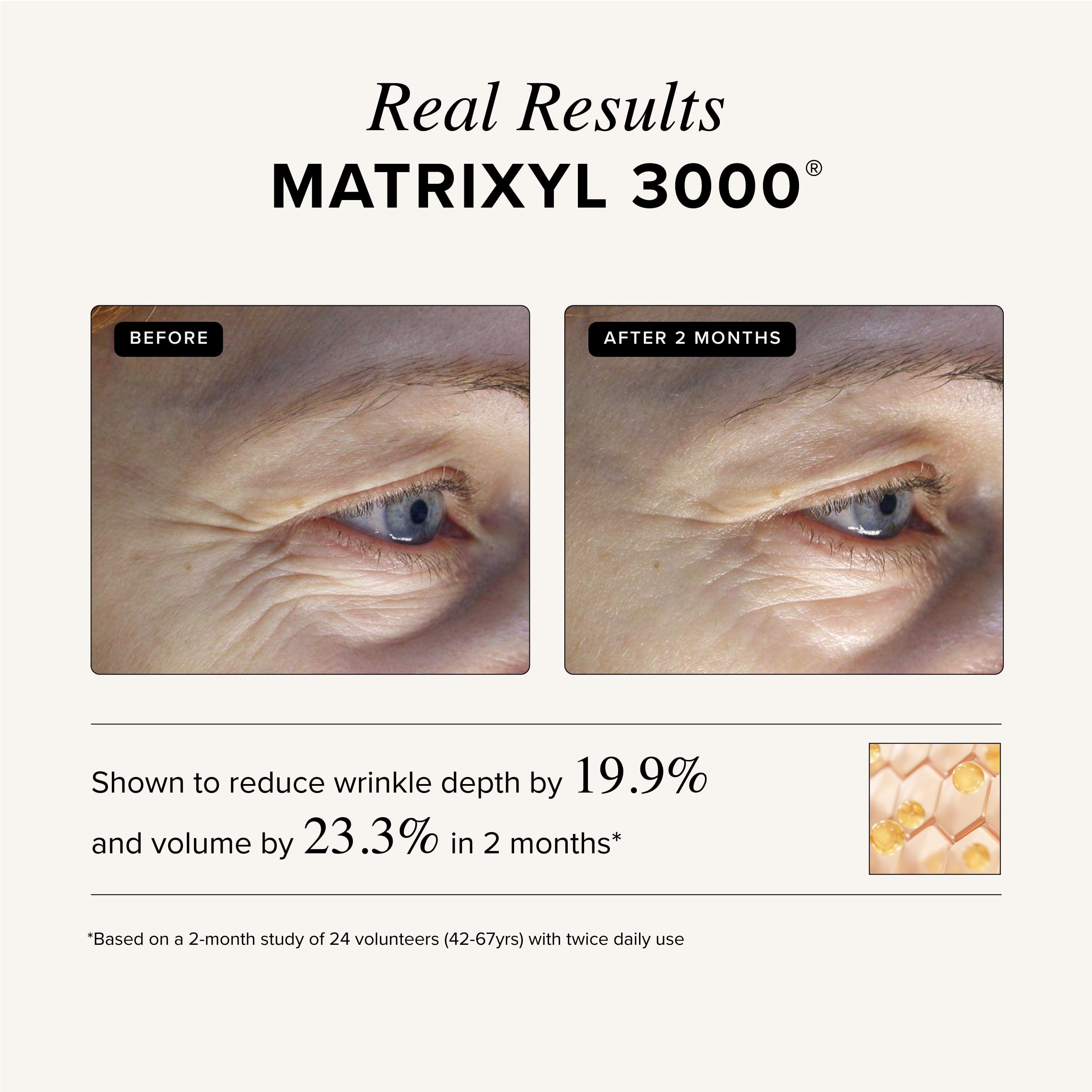 Asterwood Triple Repair Serum – Matrixyl 3000 + Argireline + Vitamin C + Hyaluronic Acid – Fragrance-Free, 1 oz