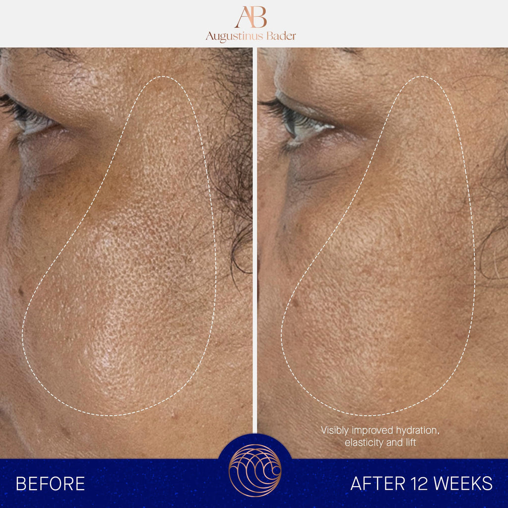 Augustinus Bader The Serum – Luxury Hydrating Anti‑Aging Serum